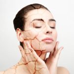 Tips Merawat juga Mengatasi Kulit Kering